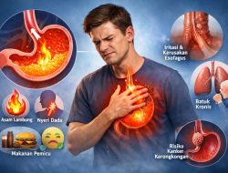Jangan Sepelekan GERD: Pentingnya Pengobatan Tuntas untuk Cegah Risiko Lain